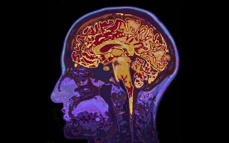 Gehirn Anatomie